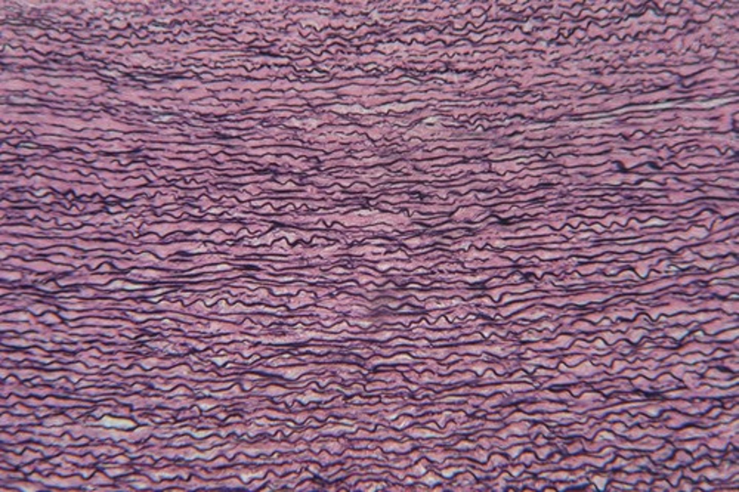 <p>dense regular connective tissue containing a high proportion of elastic fibers</p>