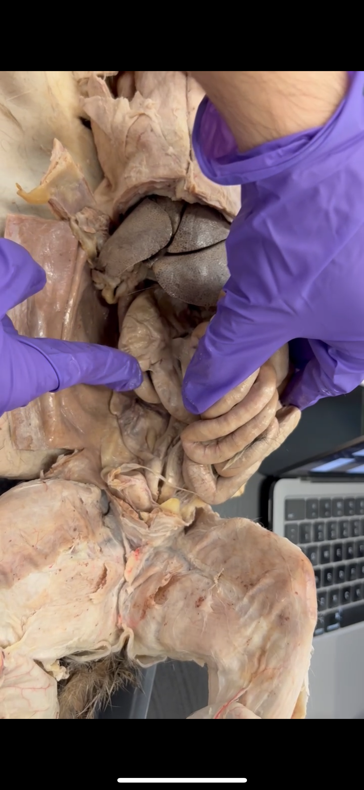 <p>What is the little pouch that connects to the ascending colon</p>