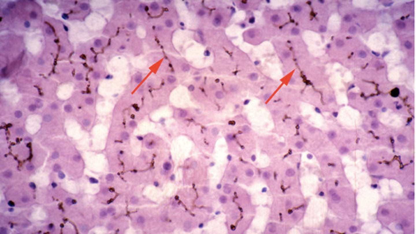 <p>little channels that connect lacunae</p>