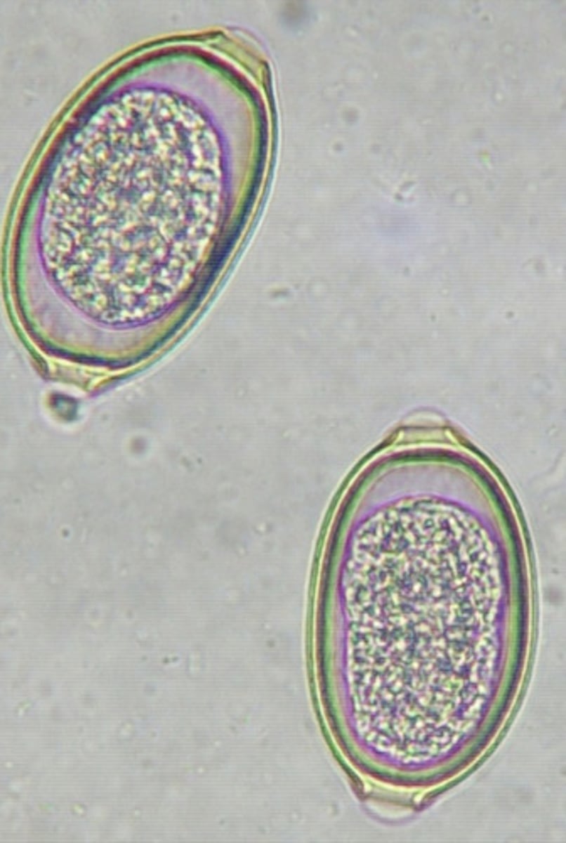 <p>Capillaria (Eucoleus) bohemi</p><p>3 multiple choice options</p>