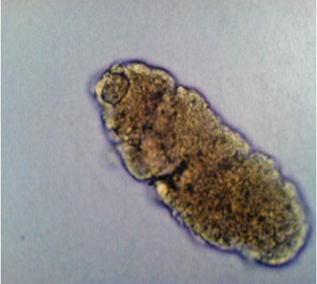 <p>What do RBC casts contain and look like?</p><p>what does it indicate?</p>