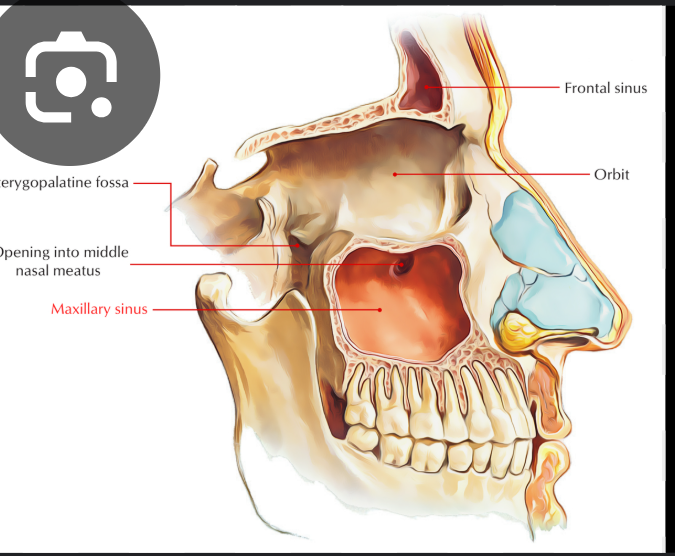 <p>Opening of the maxillary sinus</p>