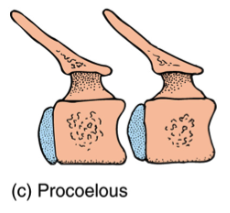 <p>Vertebrae that are concave anteriorly (toward the head), allowing for good movement in any direction, found in frogs and most reptiles.</p>