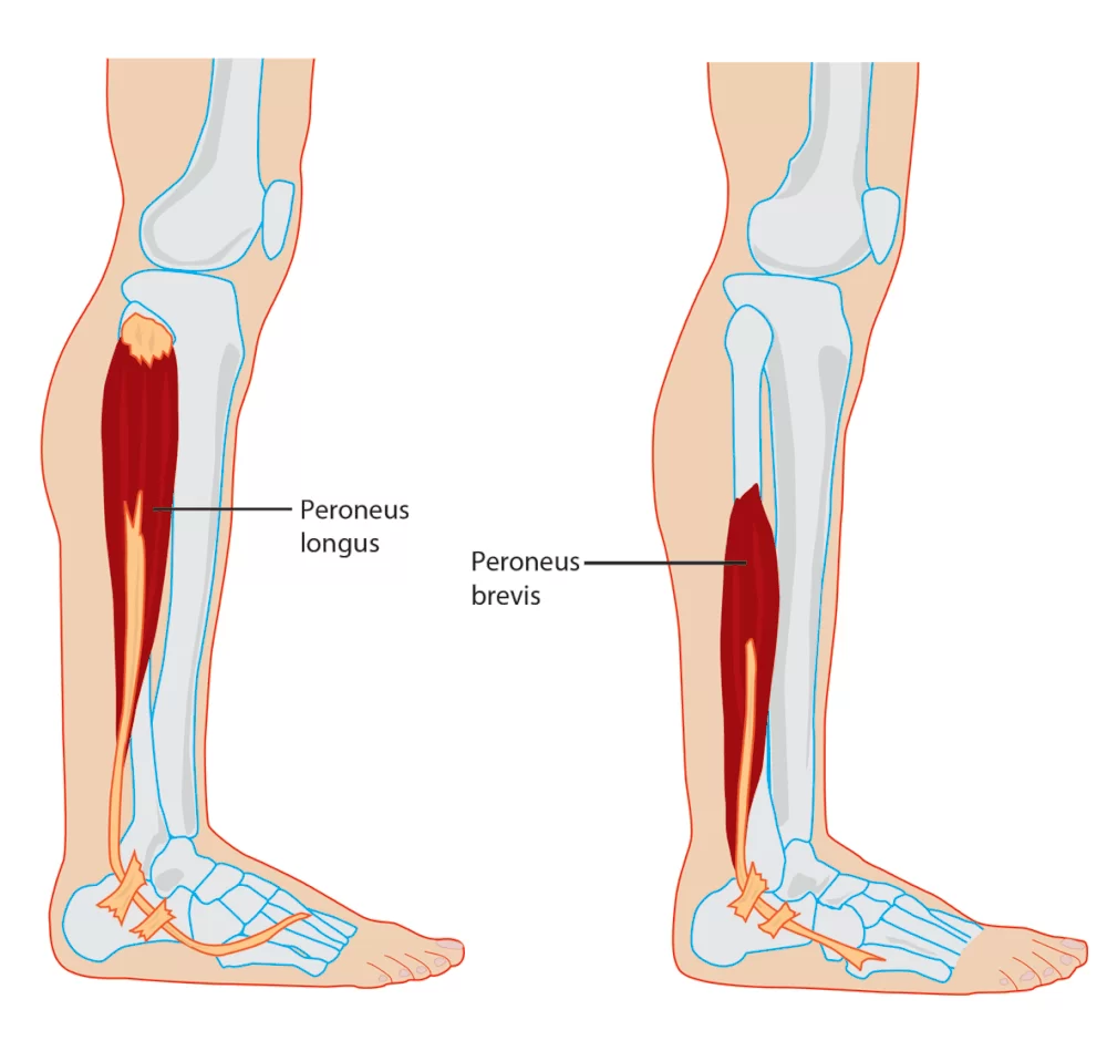 <p>A muscle that plantar flexes and everts the foot, located on the outer side of the lower leg.</p>