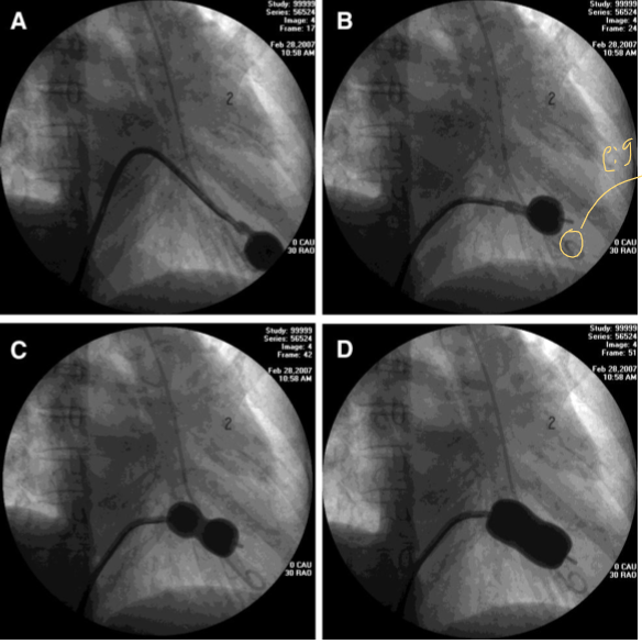 <p>WHAT PROCEDURE IS HAPPENING</p>