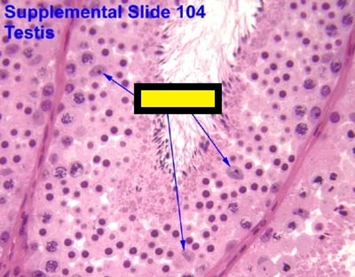<p>Cells found within the seminiferous tubules that provide metabolic support for the spermatids</p><p>- "nurse cells"</p><p>Stimulated by FSH from the pituitary gland and sends inhibin back to the pituitary gland for negative feedback.</p>