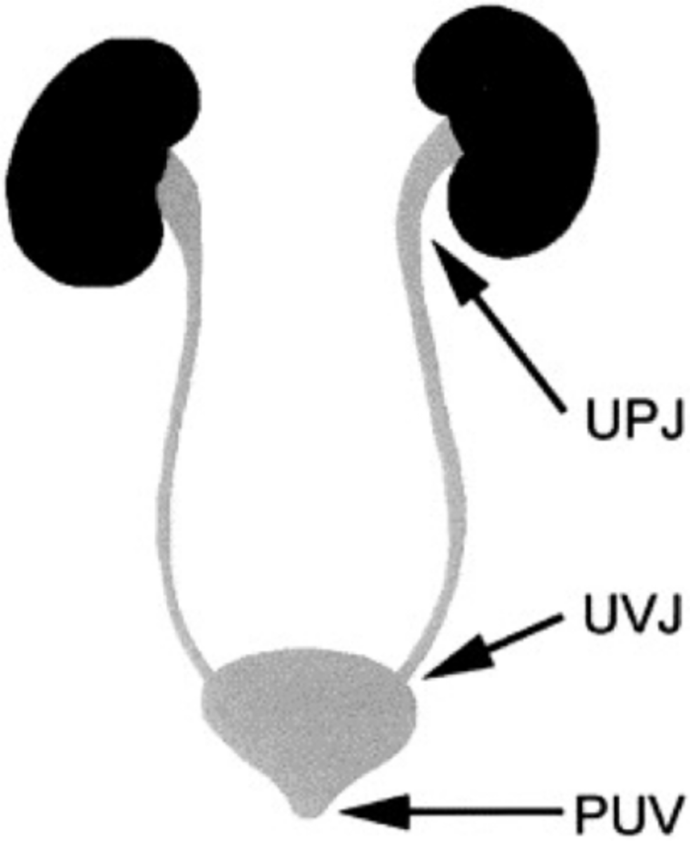 <p>At the posterior portion of the bladder at the ureterovesicular junction (UVJ).</p>