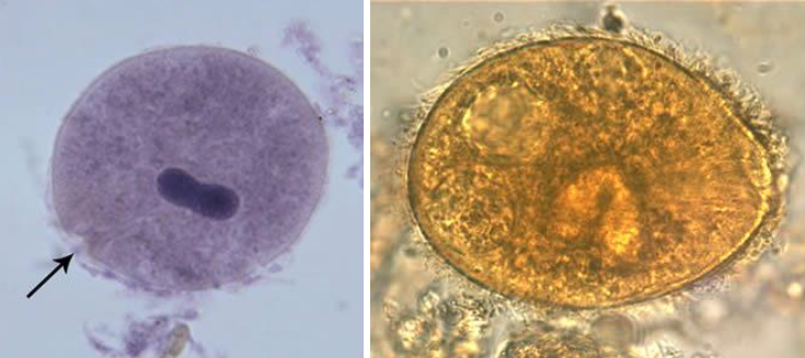 <ul><li><p>40-200 micron</p></li><li><p>cilia on surface</p></li><li><p>cystome</p></li><li><p>bean-shaped macronucleus</p></li><li><p>cysts not seen often</p></li></ul><p></p>