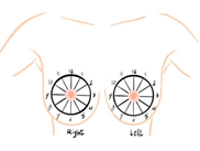 <ul><li><p>use the breast as a clock face </p></li><li><p>describe the distance from the nipple in cm using a ruler</p></li><li><p>e.g., “8:00, 2 cm from the nipple”</p></li></ul>