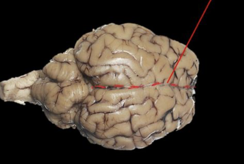 <p>Deep grove that separates the two cerebral hemispheres</p>