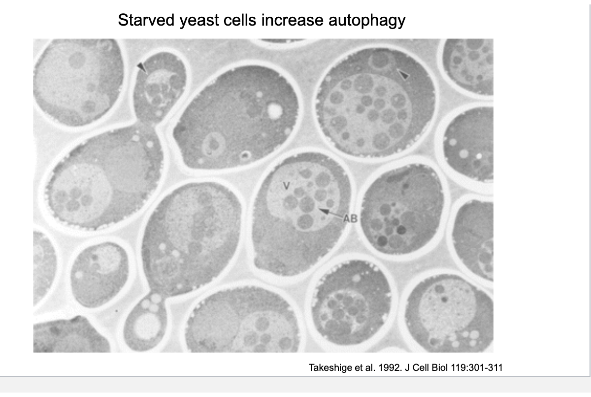 <ul><li><p>nutrient deprivation induces autophagy → break down own proteins, lipids and organelles for energy</p></li></ul><p></p>