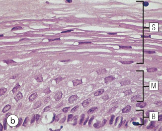 <p>what type of epithelium is shown here</p>