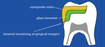 <p>what is this technique called </p>
