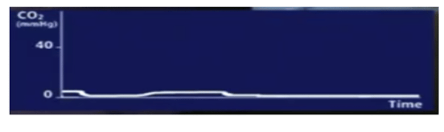 <p>¿este paciente está bien intubado?</p>