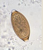 <p>what parasite is this</p>