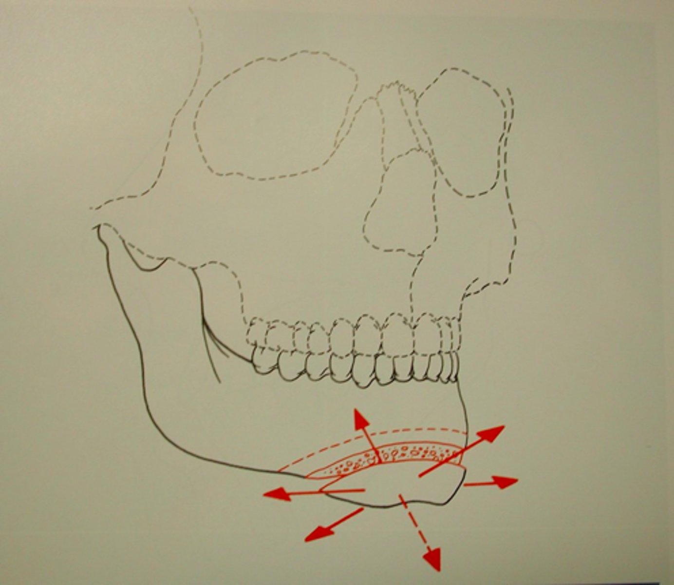 <p>ID the procedure:</p>