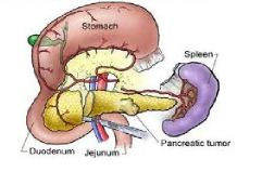 <ul><li><p><span>Exocrine function- acini cells produce digestive enzymes for digestion secreted via the pancreatic duct</span></p></li><li><p><span>Endocrine function- islets of langerhands cells produce insulin and glucagon, the control blood levels of nutrients</span></p></li><li><p><span>It delivers its endocrine hormones into the draining venous syste and its enzymes into the small intestines</span></p></li><li><p><span>The endocrine hormones help control plasma glucose concentration</span></p></li><li><p><span>Pancreatic digestive enzymes include amylase for the digestion of starch, lipase for the digestion of lipids, peptidases for protein digestion, and sodium bicarbonate to neutralize gastric acid</span></p></li></ul><p></p>