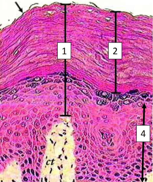<p>Stratified squamous epithelium (cross section), keratinized</p>