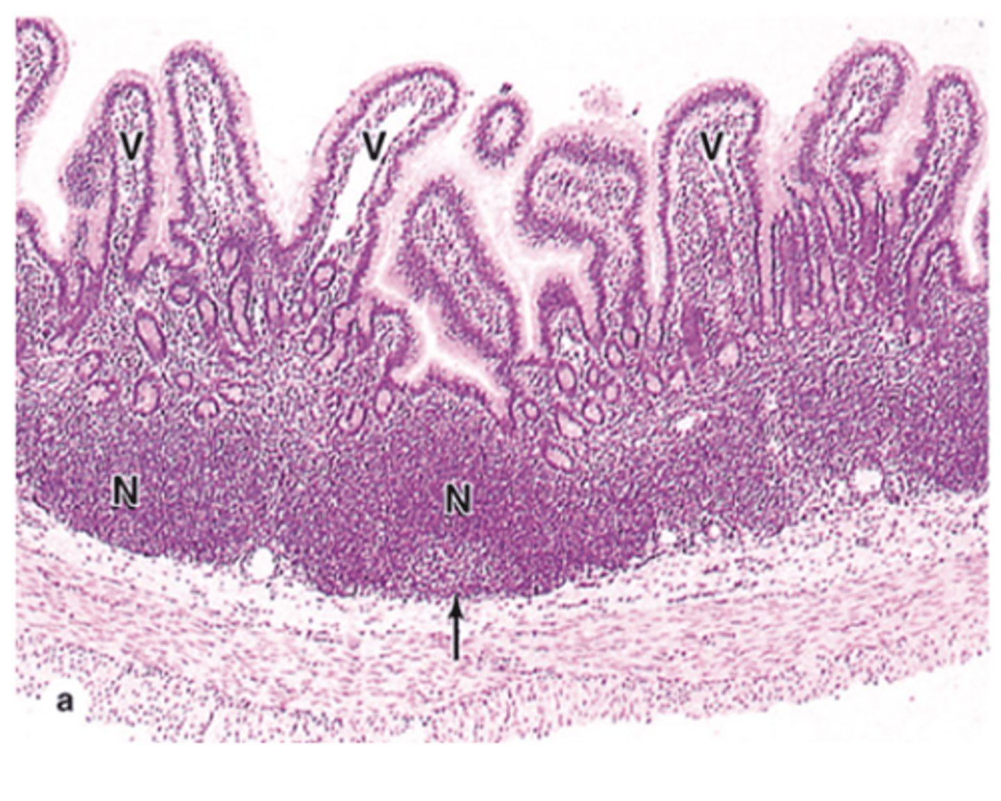<p>Besides columnar cells, what special epithelial cells are found in Peyer’s patches?</p>
