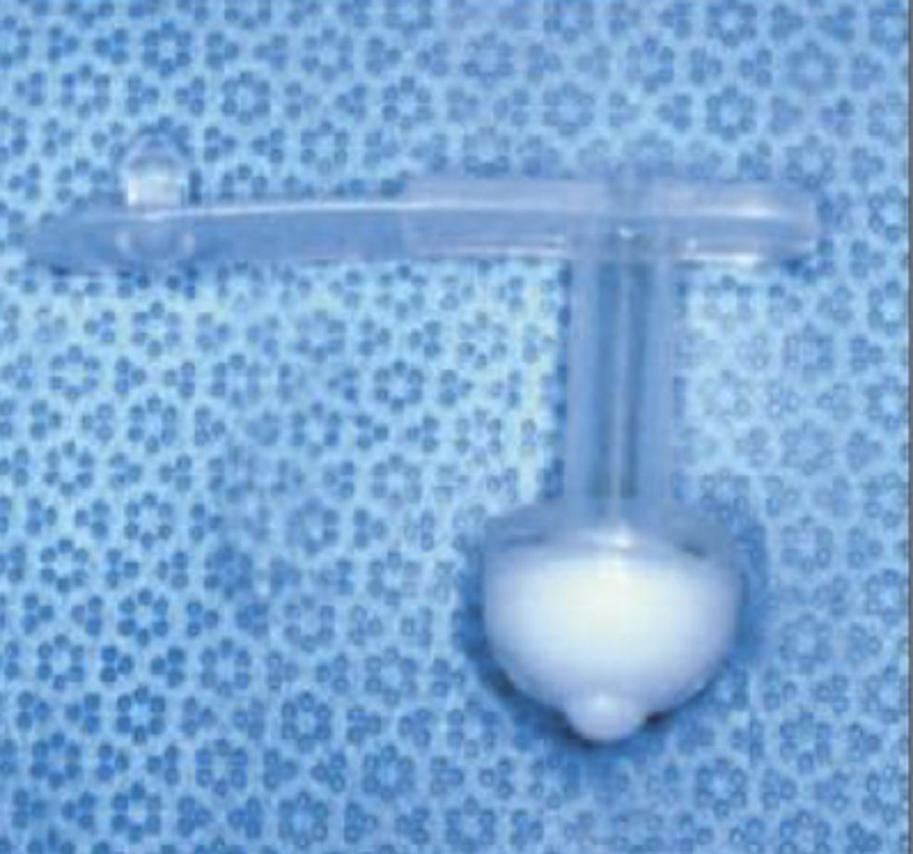 <p>What is this for prepubic catheterization which is more permanent?</p>
