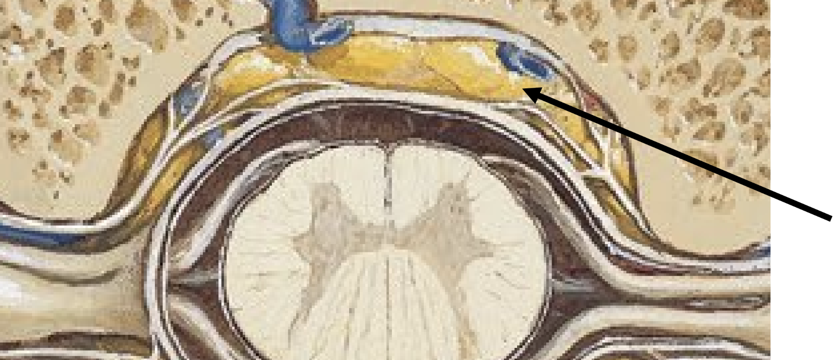 <ul><li><p>located external to dura mater</p></li><li><p>contains fat &amp; blood vessels which supply the spinal cord</p></li></ul><p></p>