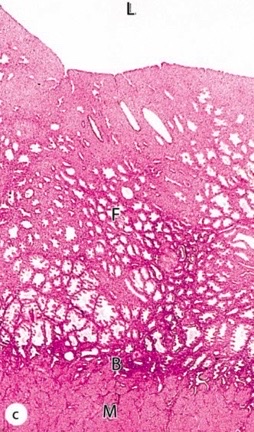 which uterine stage?