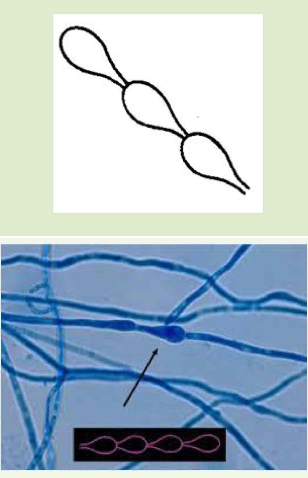 <p>Name this hyphae</p>
