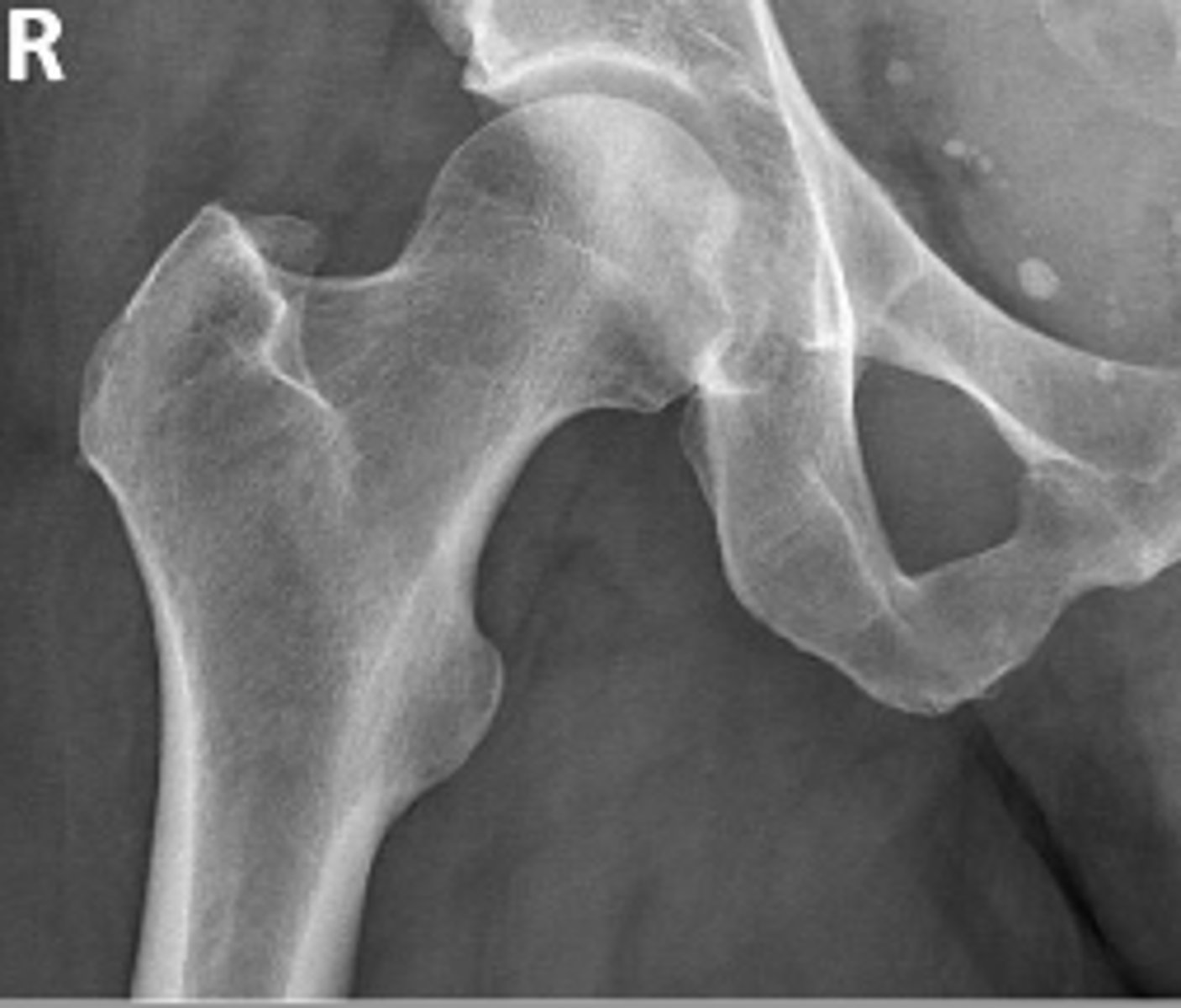 <p>What is the name of the radiographic view?</p>
