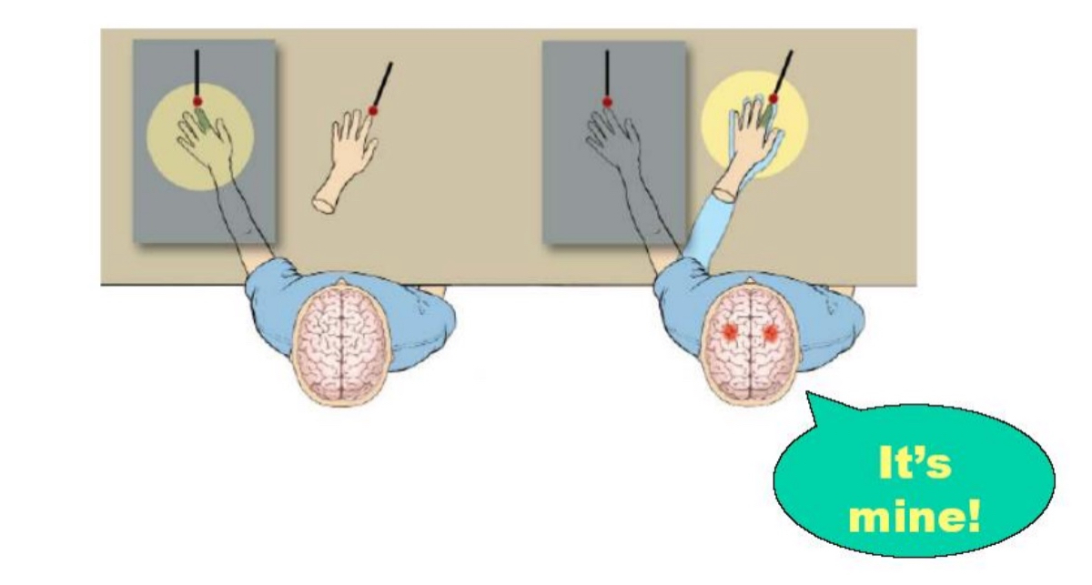 <ul><li><p>is a psychological experiment where a fake rubber hand is placed in front of a person while their real hand is hidden.</p></li><li><p>Both the fake hand and the real hand are stroked&nbsp;<strong>simultaneously and in the same way</strong>. After a short time, many people start to&nbsp;<strong>feel as if the rubber hand is their own</strong>.</p></li><li><p>This happens because the brain combines:</p><ul><li><p><strong>Visual input</strong>&nbsp;(seeing the rubber hand being touched),</p></li><li><p><strong>Tactile input</strong>&nbsp;(feeling touch on the real hand), and</p></li><li><p><strong>Proprioception</strong>&nbsp;(awareness of where your limbs are).</p></li></ul></li><li><p>When these inputs are synchronized, the brain becomes&nbsp;<strong>confused</strong>&nbsp;and&nbsp;<strong>re-maps the sense of ownership</strong>&nbsp;onto the rubber hand</p></li><li><p>It shows how&nbsp;<strong>multisensory integration</strong>&nbsp;shapes our&nbsp;<strong>sense of body ownership</strong>, and how the brain can be&nbsp;<strong>tricked</strong>&nbsp;into adopting external objects as part of the self when sensory signals line up. It also highlights the brain’s&nbsp;<strong>flexibility and dependence on vision</strong>&nbsp;for body perception.</p></li><li><p>The illusion doesn’t work if the touch is not synchronized — timing matters.</p></li><li><p>It’s often used to study&nbsp;<strong>body image</strong>,&nbsp;<strong>phantom limb pain</strong>, and even conditions like&nbsp;<strong>schizophrenia</strong>.</p></li><li><p>Brain areas involved include the&nbsp;<strong>premotor cortex</strong>&nbsp;and&nbsp;<strong>posterior parietal cortex</strong>, which are involved in mapping the body and integrating sensory signals.</p></li></ul><p></p>