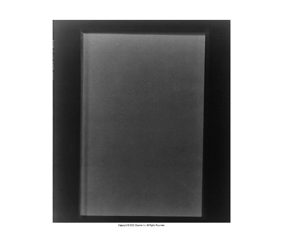 <p>What does this image tell you about contrast</p>