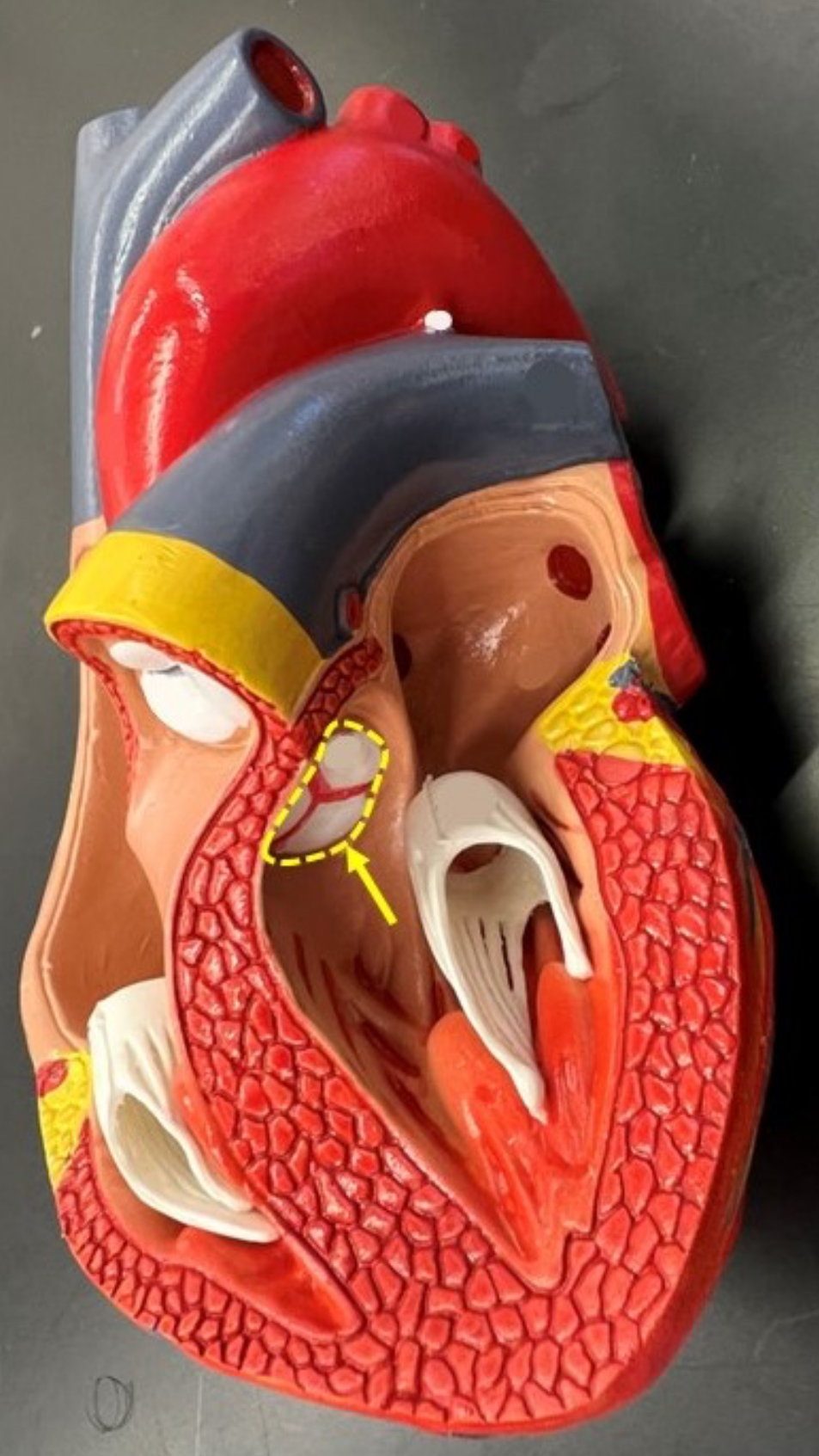 term image