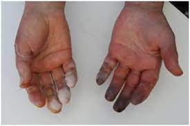 <p>This is an example of what condition?</p>