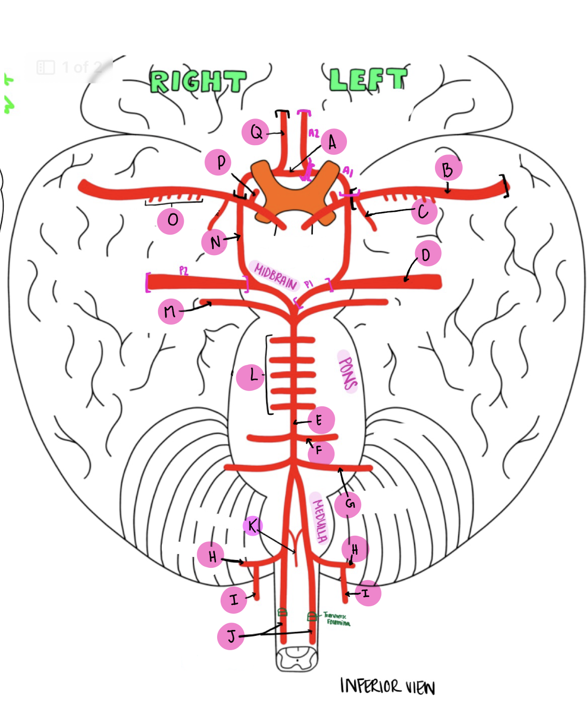 <p>What artery is labeled E?</p>