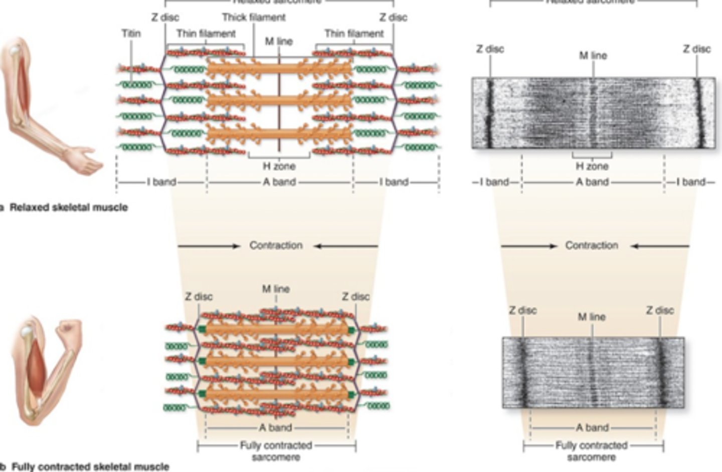 <p>Which band is reduced in size during contraction?</p>