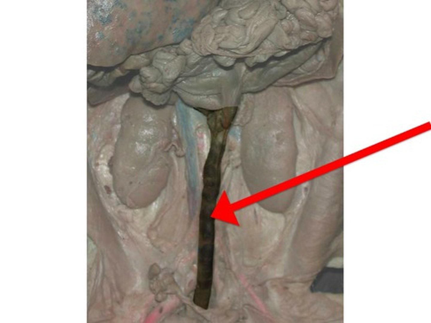 <p>A short tube at the end of the large intestine where waste material is compressed into a solid form before being eliminated.</p>