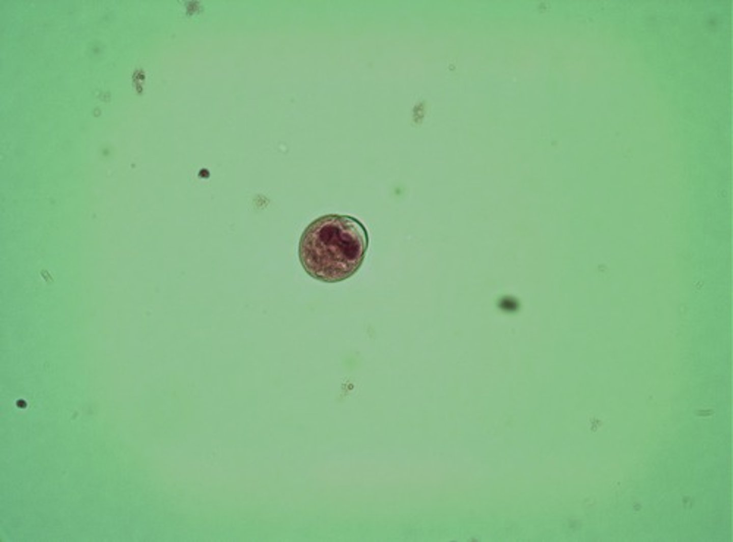 <p>Has double walled yeast cell</p>