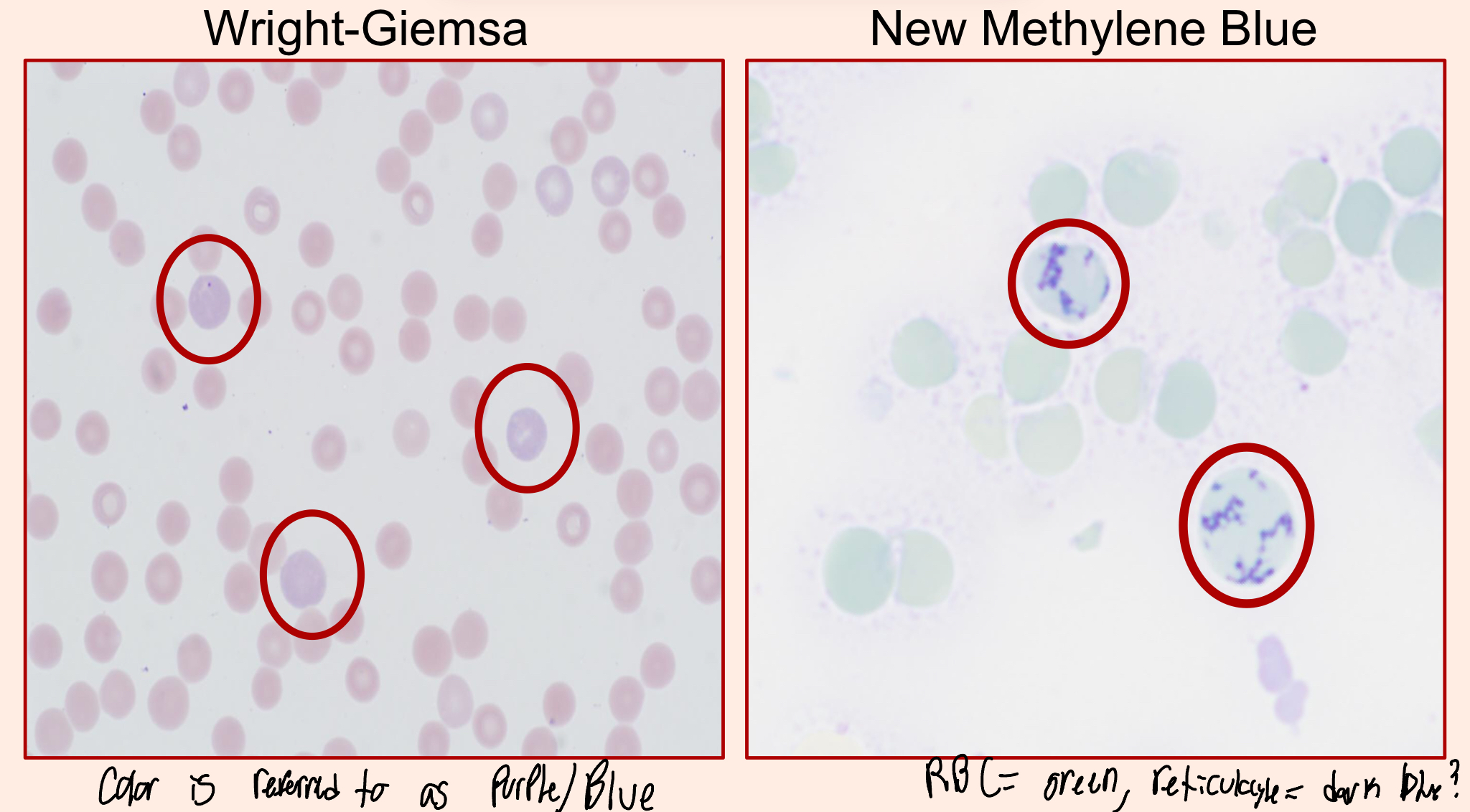 <ul><li><p>Anucleate, Immature erythrocytes with stainable cytoplasmic RNA</p></li><li><p>The difference is in the staining</p><ul><li><p>Wright-Giemsa stain = Polychromatophils</p></li><li><p>New Methylene Blue = Reticulocytes</p></li></ul></li></ul><p></p>
