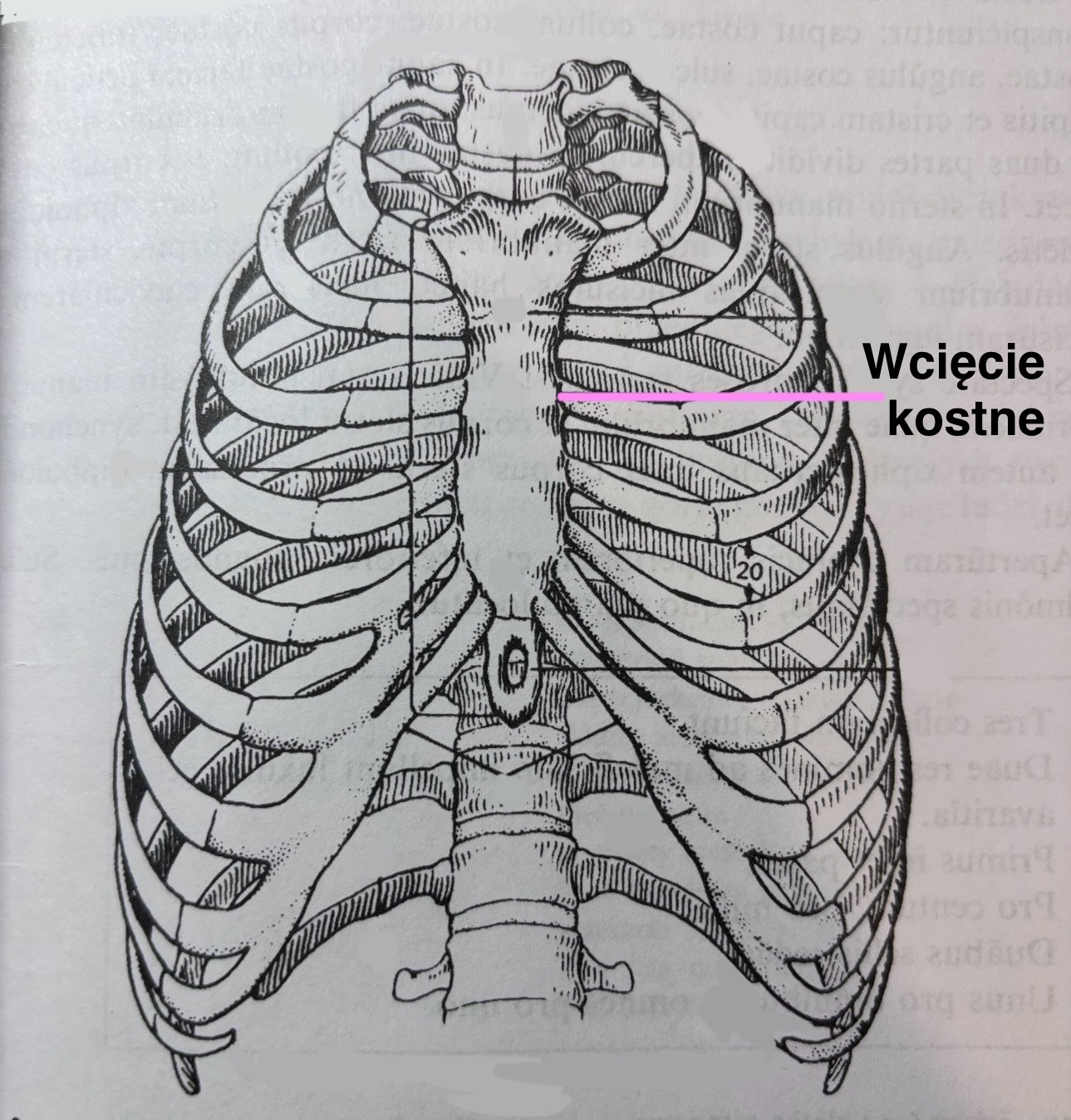 <p>Wcięcie kostne</p>