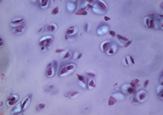 <p>What cells produce this tissue? chondrocytes</p><p>Location: End of boNes, trachea rings, costal (ribs)</p><p>Function: Support and cushioning</p>