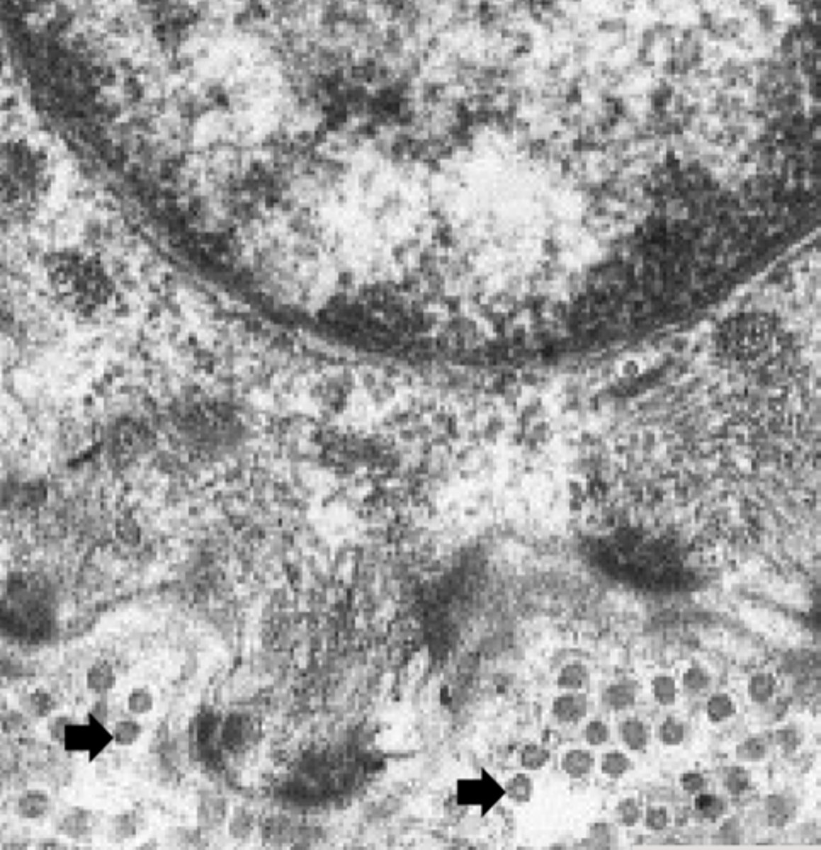 <p>What are the arrows pointing to in this electron micrograph?</p>