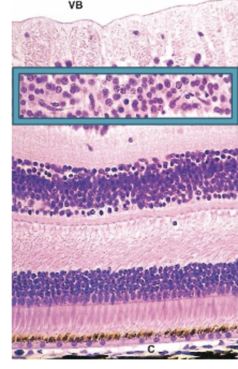 <p>Identify the Layers of the neural retina</p>