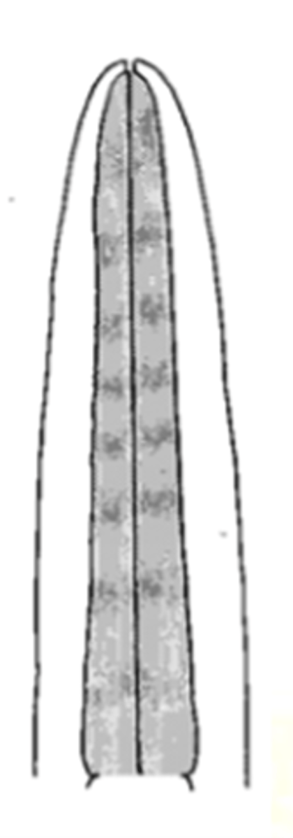 <p>(aka filariform) type of esophagus that lacks an esophageal bulb</p>