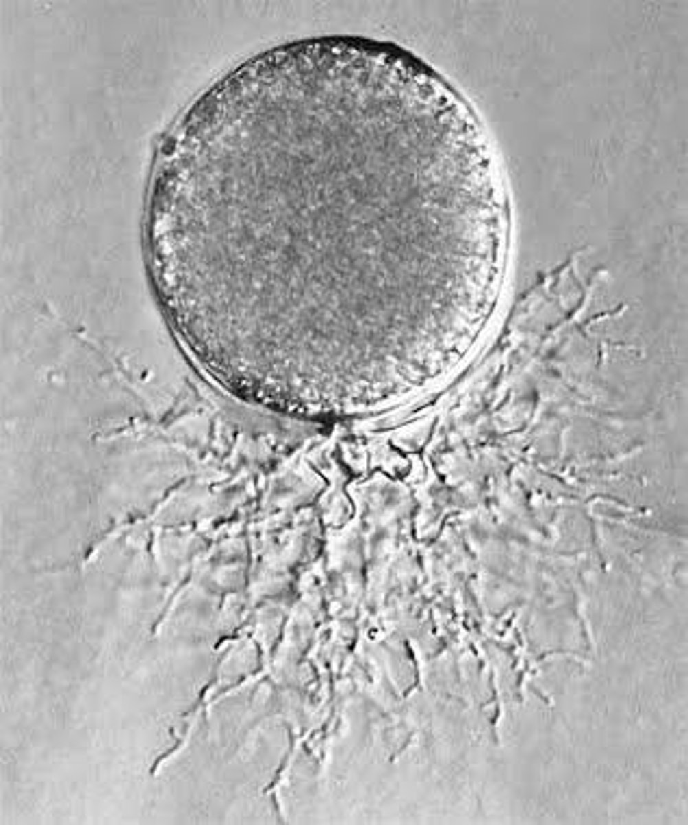 <p>Sac-like structure producing asexual spores in fungi.</p>