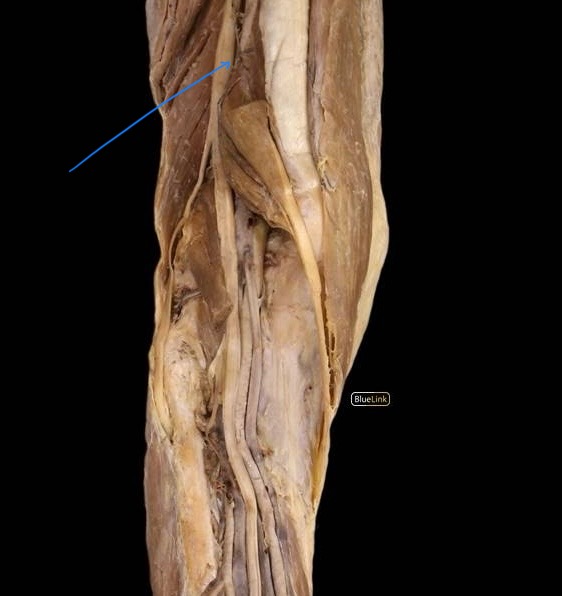 <p>A major nerve in the lower limb that runs from the lower back down the leg, composed of fibers from the lumbar and sacral plexuses.</p><p></p><p>innervates: nothing</p>
