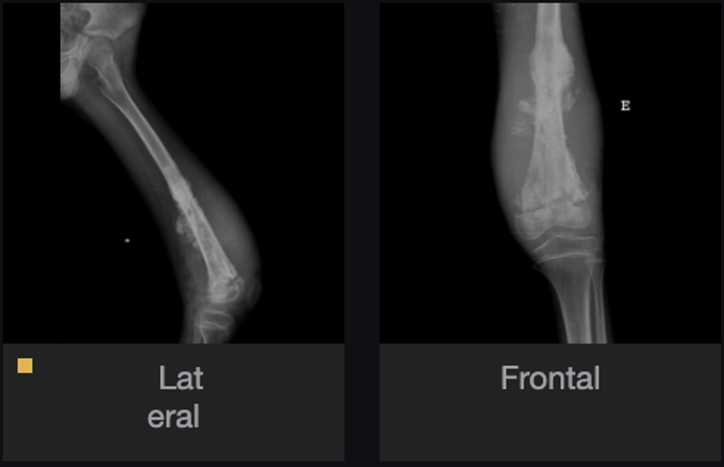 <p>Bone</p>