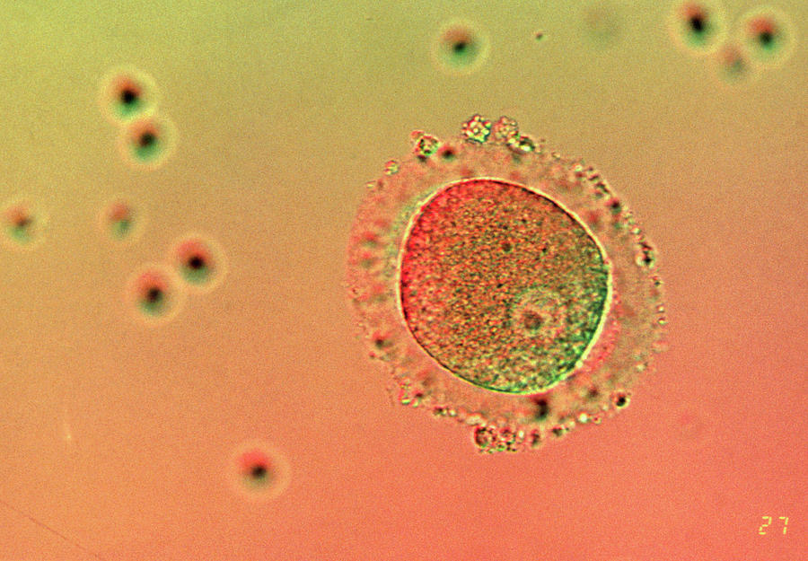 <p>The first cell of a new individual</p>
