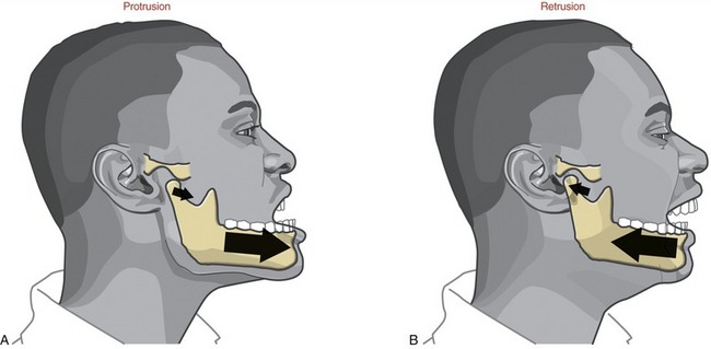 <p>retrusion</p>