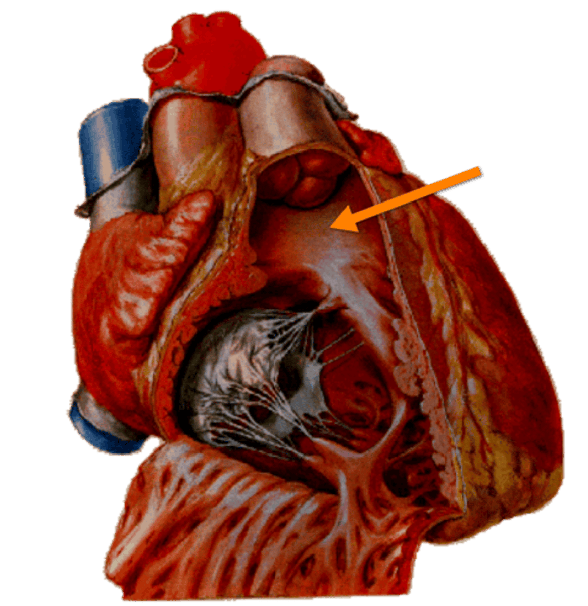 <p>smooth muscle wall, forming a superior narrowing of the ventricle, which leads into the pulmonary trunk</p>