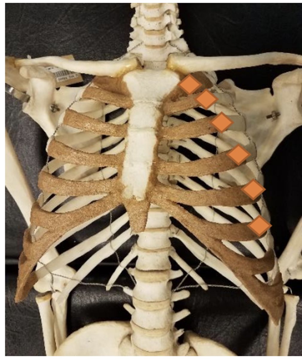 <p>superior aspect of 2nd rib at midclavicular line</p>