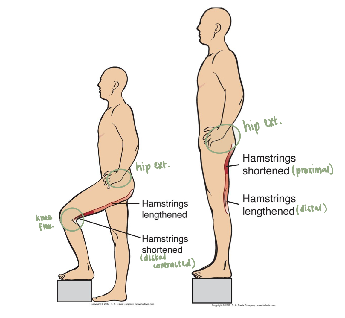 <ul><li><p>In order to allow for one part of the muscle to have enough ability to generate the force the other one has to slack off</p><ul><li><p>If both muscles are in optimal tension = no function</p></li></ul></li><li><p>Ex: Hamstrings (cross hip & knee joint) - hip extension & knee flexion</p><ul><li><p>In order to allow the hip to work through the two positions, one must shorten, one must lengthen </p></li><li><p>one portion has to tighten, other relaxes</p></li></ul></li></ul><p></p>
